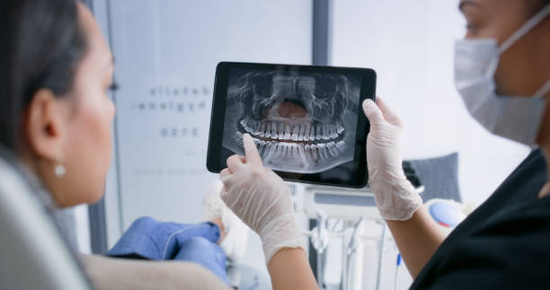 Licensed Dental Implants service in Oceanside, NY - Smile Center Dentistry