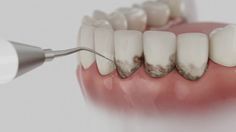 Reliable Dental contractor in Oceanside, NY by Smile Center Dentistry